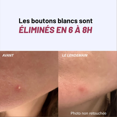 PATCHS Hydrocolloïdes