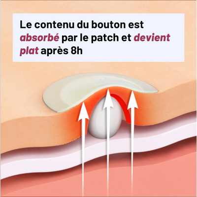 PATCHS Hydrocolloïdes