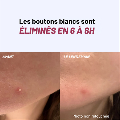 PATCHS Hydrocolloïdes