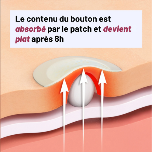 PATCHS Hydrocolloïdes