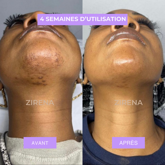 HUILE ANTI-POILS NUIT