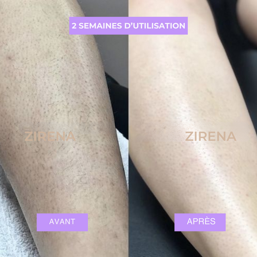 HUILE ANTI-POILS NUIT