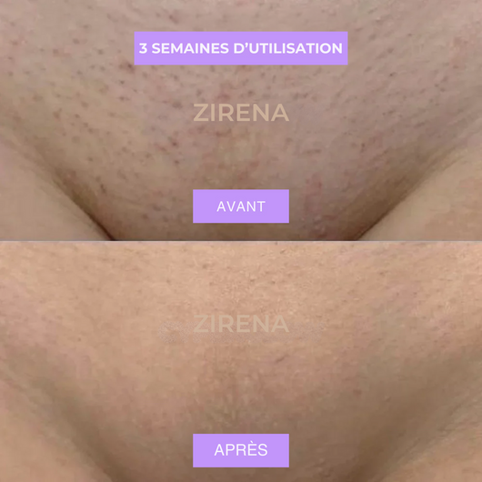 HUILE ANTI-POILS NUIT