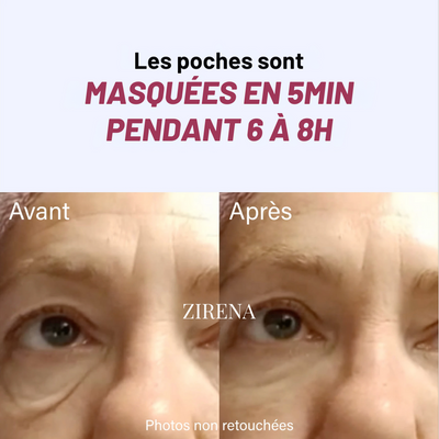 Gel liftant instantané